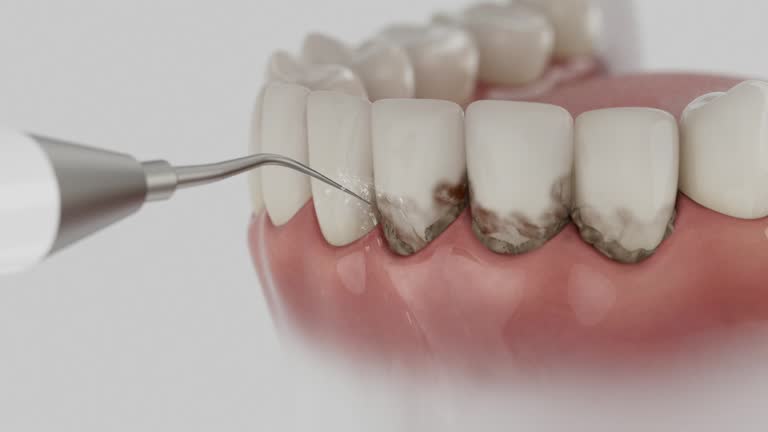 Trusted Tooth Extraction service in Mount Vernon, WA - Dentist Open Now